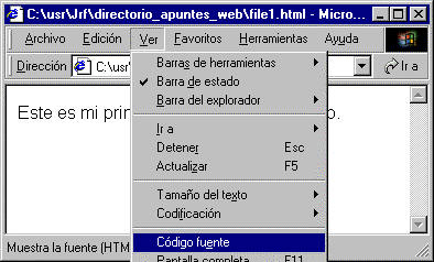 Recurso propio